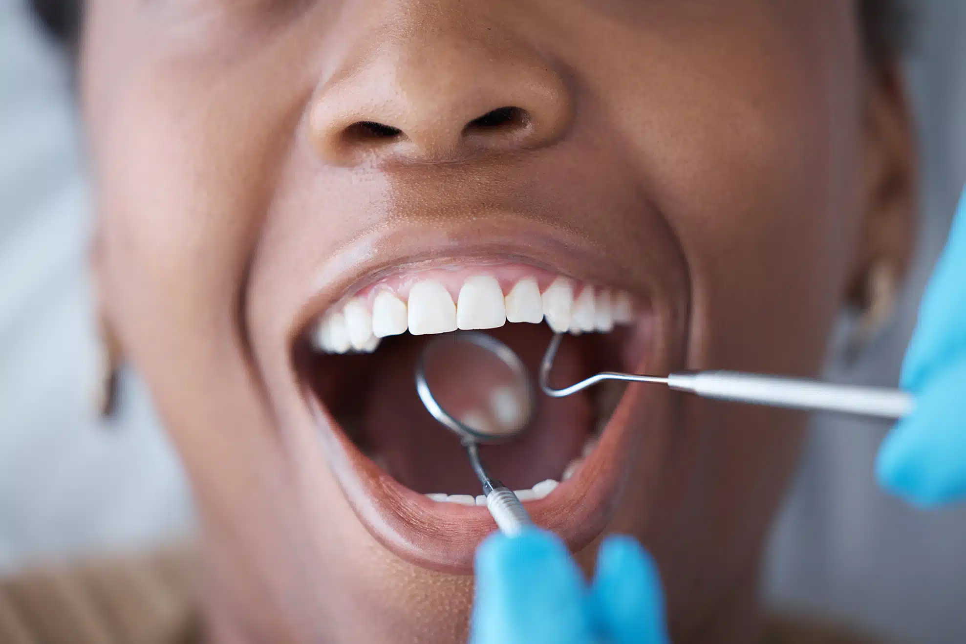 Woman happy with her dental cleaning at Stephan Family Dental in Westerville OH